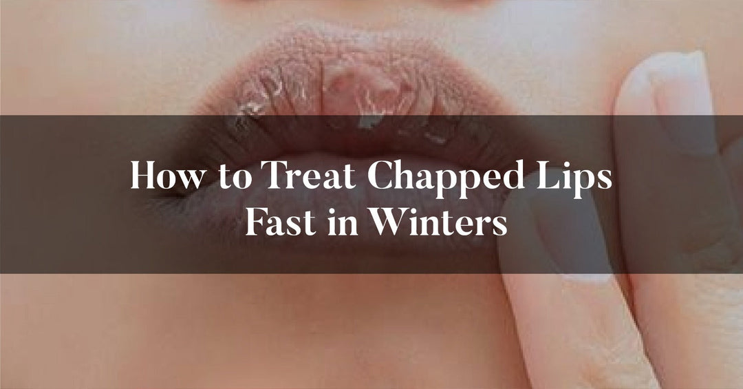 How to Treat Chapped Lips Fast in Winters