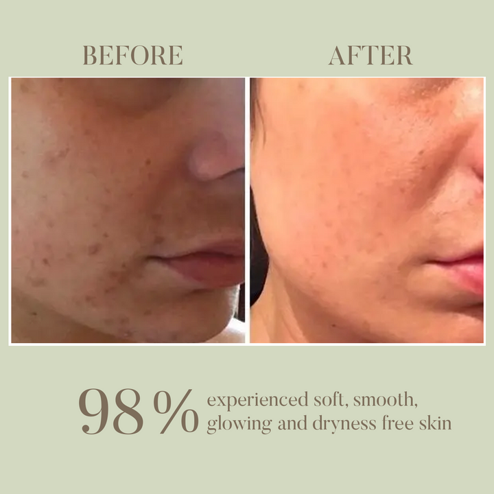 Shrikamya Facial Beauty Oil- Skin Brightening OHRIA AYURVEDA