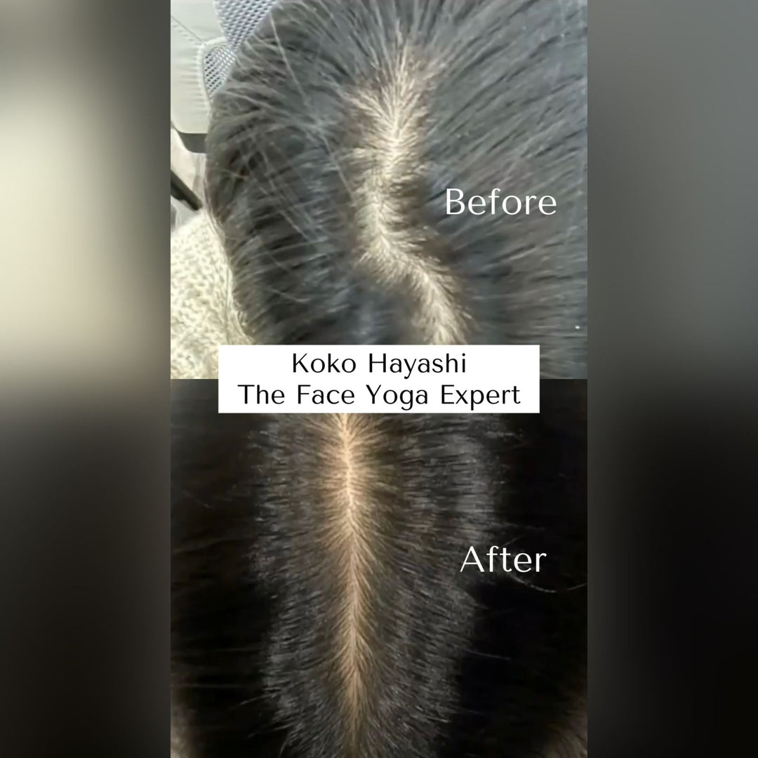 Keshya Hair Vitalizer -Hair Growth Serum OHRIA AYURVEDA