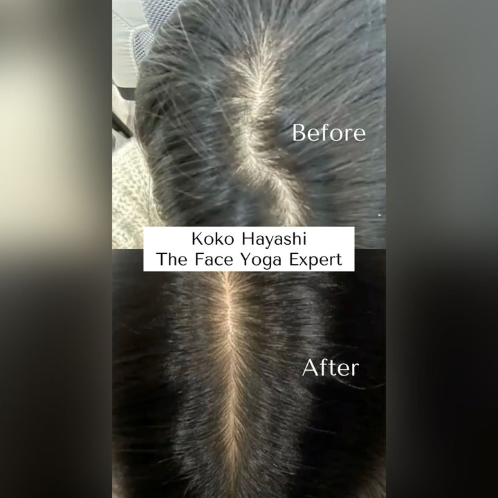 Keshya Hair Vitalizer -Hair Growth Serum OHRIA AYURVEDA
