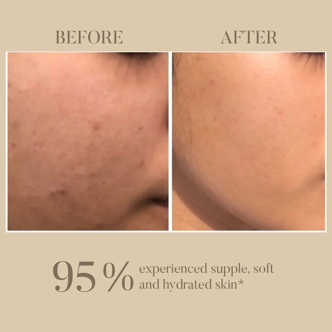95% hydrated skin after using Rose & Pomegranate Cream - OHRIA AYURVEDA