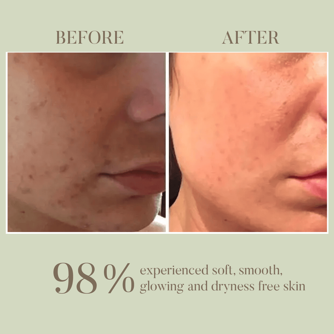 Shrikamya Facial Beauty Oil- Skin Brightening OHRIA AYURVEDA